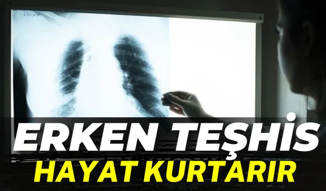 Dünya’da Her Yıl 10 Milyondan Fazla Kişi Yakalanıyor! Erken Teşhis Hayat Kurtarır