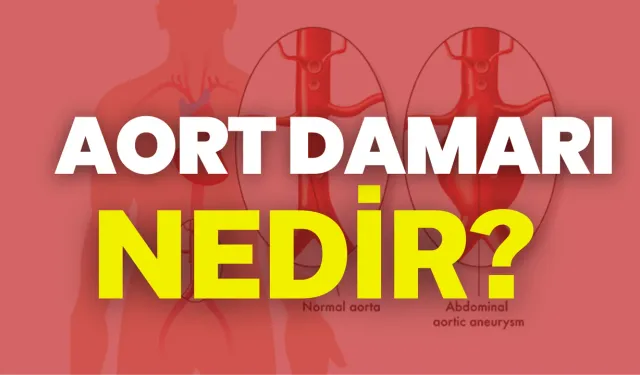 Aort Damarı Nedir? Aort Damarı Neden Yırtılır?