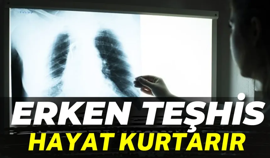 Dünya’da Her Yıl 10 Milyondan Fazla Kişi Yakalanıyor! Erken Teşhis Hayat Kurtarır